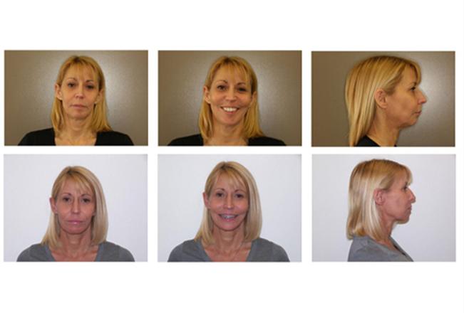 Adult Epigenetic Orthodontics | Sana Dental | General & Family Dentist | North Edmonton