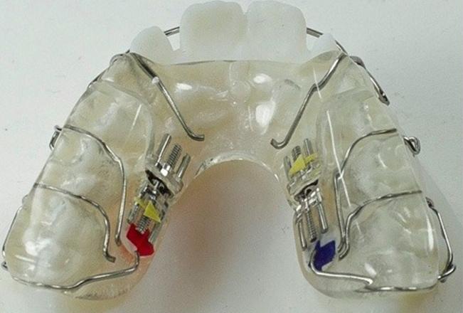 Children's Epigenetic Orthodontics | Sana Dental | General & Family Dentist | North Edmonton