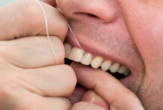 Dental Crowns Maintenance | Sana Dental | General & Family Dentist | North Edmonton
