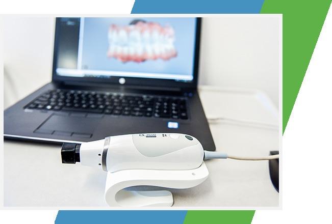 Intra Oral Camera Technology | Sana Dental | North Edmonton Dentist | Edmonton, AB