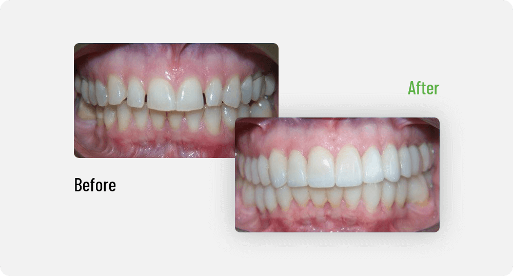 Laurel | Sana Dental | General & Family Dentist | North Edmonton