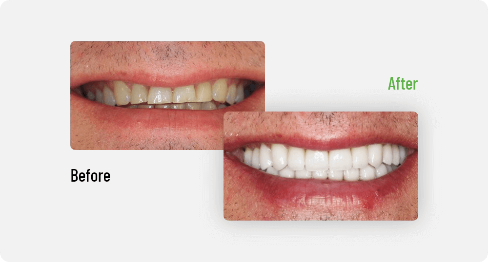 lenn Before After Images | General & Family Dentist | North Edmonton