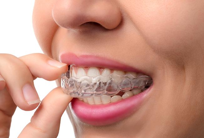 Edmonton Orthodontics | Sana Dental | General & Family Dentist | North Edmonton