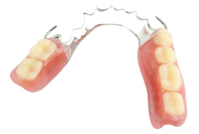 Partial Dentures | Sana Dental | General & Family Dentist | North Edmonton