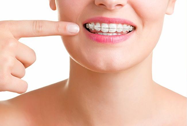 Edmonton Traditional Braces | Sana Dental | General & Family Dentist | North Edmonton