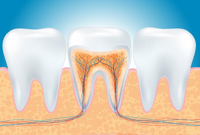 Root Canal Therapy | Sana Dental | General & Family Dentist | North Edmonton