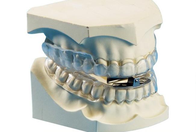Edmonton MADS Appliance | Sana Dental | General & Family Dentist | North Edmonton