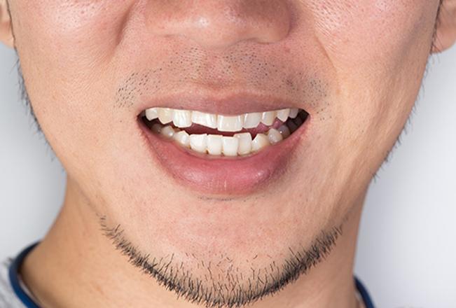 TMJ Therapy | Sana Dental | General & Family Dentist | North Edmonton