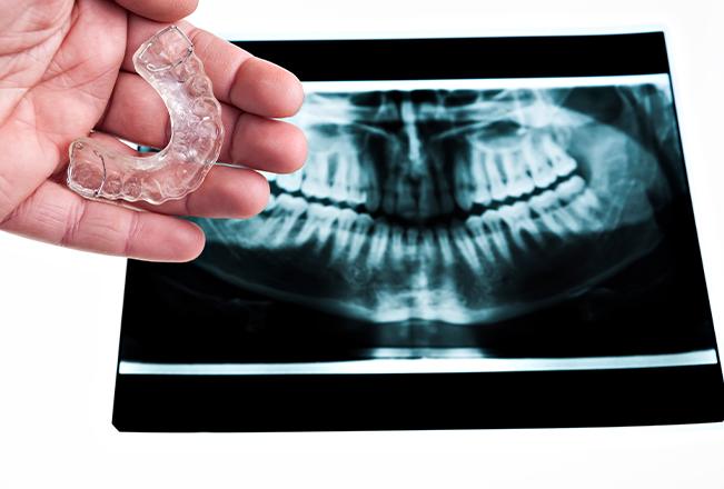 Edmonton Night Guard | Sana Dental | General & Family Dentist | North Edmonton