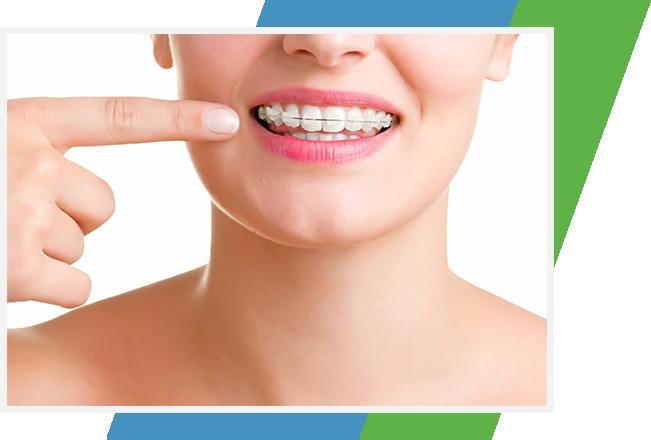 Traditional Braces Service | Sana Dental | North Edmonton Dentist | Edmonton, AB